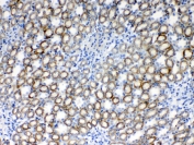IHC testing of FFPE rat kidney tissue with RPS6 antibody at 1ug/ml. Required HIER: steam section in pH6 citrate buffer for 20 min and allow to cool prior to testing.