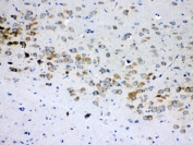 IHC testing of FFPE rat brain tissue with RPS6 antibody at 1ug/ml. Required HIER: steam section in pH6 citrate buffer for 20 min and allow to cool prior to testing.