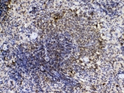 IHC testing of FFPE mouse intestine tissue with Cyclophilin A antibody at 1ug/ml. Required HIER: steam section in pH6 citrate buffer for 20 min and allow to cool prior to testing.