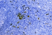 IHC testing of FFPE human tonsil tissue with Hemoglobin antibody. Required HIER: steam section in pH8 EDTA buffer for 20 min and allow to cool prior to testing.