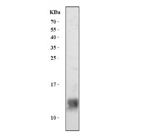 Western blot testing of human placental tissue lysate with Hemoglobin antibody. Predicted molecular weight ~15 kDa.