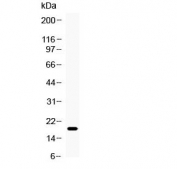 Western blot testing of human HeLa cell lysate with CTAG1A antibody at 0.5ug/ml. Predicted molecular weight ~18 kDa.