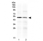 Western blot testing of human 1) PANC1 and 2) HepG2 cell lysate with HtrA3 antibody at 0.5ug/ml. Predicted molecular weight ~49 kDa.