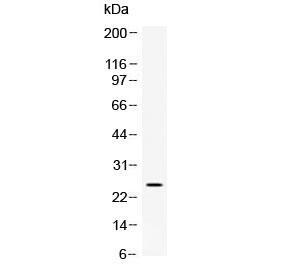 Western blot testing of rat kidney lysate with Vegf antibody at 0.5ug/ml. Predicted molecular weight 19~22 kDa (monomer) and 38~44 kDa (dimer).