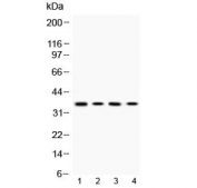 Western blot testing of 1) rat PC12, 2) mouse Hepa1-6, 3) human HeLa and 4) human A375 cell lysate with MC1R antibody at 0.5ug/ml.  Predicted molecular weight ~35 kDa.
