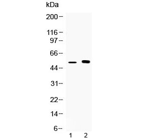 Western blot testing of 1) mouse kidney and 2) human MCF7 lysate with CDR2 antibody at 0.5ug/ml. Predicted molecular weight ~52 kDa.