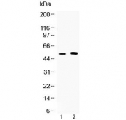 Western blot testing of 1) mouse kidney and 2) human MCF7 lysate with CDR2 antibody at 0.5ug/ml. Expected molecular weight: 52-62 kDa.