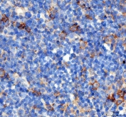 IHC staining of FFPE rat lymph tissue with PD-1 antibody. HIER: boil tissue sections in pH8 EDTA for 20 min and allow to cool before testing.