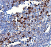 IHC staining of FFPE mouse lymph tissue with PD-1 antibody. HIER: boil tissue sections in pH8 EDTA for 20 min and allow to cool before testing.