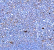 IHC staining of FFPE rat thymus tissue with PD-1 antibody. HIER: boil tissue sections in pH8 EDTA for 20 min and allow to cool before testing.