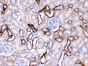 IHC testing of FFPE rat kidney tissue with GAD65 antibody at 1ug/ml. Required HIER: steam section in pH6 citrate buffer for 20 min and allow to cool prior to testing.