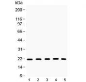Western blot testing of 1) rat thymus, 2) mouse thymus, 3) mouse Hepa1-6, 3) human HeLa, 4) human MCF7 lysate with Bax antibody at 0.5ug/ml. Predicted molecular weight: 21-24 kDa.