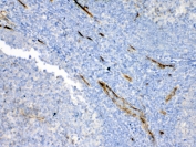 IHC testing of FFPE human tonsil tissue with Bcl-XL antibody at 1ug/ml. Required HIER: steam section in pH6 citrate buffer for 20 min and allow to cool prior to testing.