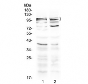 Western blot testing of 1) rat brain and 2) mouse brain lysate with TRPC3 antibody at 0.5ug/ml. Predicted molecular weight ~96/106/97 kDa (isoforms 1/2/3).