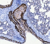 IHC staining of FFPE mouse lung tissue with CD166 antibody. HIER: boil tissue sections in pH8 EDTA for 20 min and allow to cool before testing.