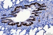 IHC staining of FFPE rat lung tissue with CD166 antibody. HIER: boil tissue sections in pH8 EDTA for 20 min and allow to cool before testing.