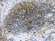 IHC testing of FFPE mouse spleen tissue with GAS6 antibody at 1ug/ml. Required HIER: steam section in pH6 citrate buffer for 20 min and allow to cool prior to testing.