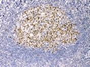 IHC testing of FFPE human tonsil tissue with TRF2 antibody at 1ug/ml. Required HIER: steam section in pH6 citrate buffer for 20 min and allow to cool prior to testing.