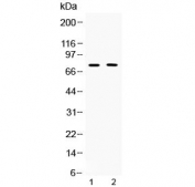 Western blot testing of 1) rat thymus and 2) human COLO320 lysate with TRF2 antibody at 0.5ug/ml. Predicted molecular weight ~75 kDa.