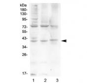 Western blot testing of human 1) HeLa, 2) HepG2 and 3) A431 cell lysate with HFE antibody at 0.5ug/ml. Predicted molecular weight ~40 kDa.