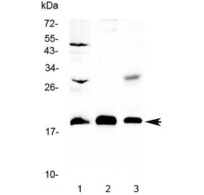 Western blot testing of 1) rat brain, 2) mouse NIH3T3 and 3) human COLO320 lysate with TMEM240 antibody at 0.5ug/ml. Predicted molecular weight ~20 kDa.