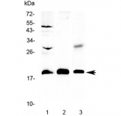 Western blot testing of 1) rat brain, 2) mouse NIH3T3 and 3) human COLO320 lysate with TMEM240 antibody at 0.5ug/ml. Predicted molecular weight ~20 kDa.