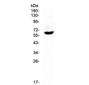 Western blot testing of mouse spleen lysate with Heparanase antibody at 0.5ug/ml. Predicted molecular weight: 61 kDa (isoform 1), ~53 kDa (isoform 2/3), ~43 kDa (isoform 4).