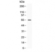 Western blot testing of mouse brain lysate with CKAP4 antibody at 0.5ug/ml. Predicted molecular weight ~64 kDa.