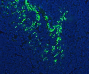 Immunofluorescent staining of FFPE human tonsil tissue with FDCSP antibody (green) and DAPI nuclear stain (blue). HIER: steam section in pH8 EDTA buffer for 20 min.~