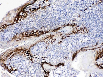IHC testing of FFPE human tonsil tissue with FDCSP antibody at 1ug/ml. Required H