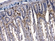 IHC testing of FFPE rat intestine tissue with Cytoglobin antibody at 1ug/ml. Required HIER: steam section in pH6 citrate buffer for 20 min and allow to cool prior to testing.