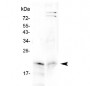 Western blot testing of 1) rat small intestine and 2) mouse small intestine lysate with Cytoglobin antibody at 0.5ug/ml. Predicted molecular weight ~21 kDa.