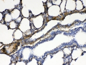IHC testing of FFPE rat lung tissue with CPI-17 antibody at 1ug/ml. Required HIER: steam section in pH6 citrate buffer for 20 min and allow to cool prior to testing.
