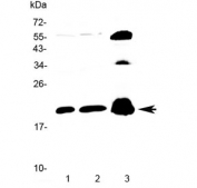Western blot testing of 1) rat brain, 2) mouse brain and 3) human PANC1 lysate with CPI-17 antibody at 0.5ug/ml. Predicted molecular weight ~17 kDa.
