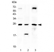 Western blot testing of 1) rat heart, 2) mouse heart and 3) human HeLa lysate with TIMP4 antibody at 0.5ug/ml. Predicted molecular weight ~25 kDa.