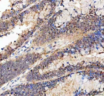 IHC testing of FFPE mouse testis tissue with BAG1 antibody at 1ug/ml. Required HIER: steam section in pH6 citrate buffer for 20 min and allow to cool prior to testing.