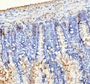 IHC staining of FFPE rat colon tissue with BAG1 antibody. HIER: boil tissue sections in pH8 EDTA for 20 min and allow to cool before testing.