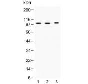 Western blot testing of 1) rat testis, 2) mouse testis and 3) MCF7 lysate with ADAM2 antibody at 0.5ug/ml. Predicted molecular weight ~82 kDa, but can be observed at ~100 kDa.