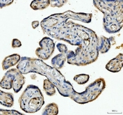 IHC staining of FFPE human placental tissue with ANGPTL4 antibody. HIER: boil tissue sections in pH8 EDTA for 20 min and allow to cool before testing.