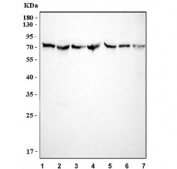 Western blot testing of 1) human HL60, 2) human K562, 3) human HepG2, 4) rat liver, 5) rat PC-12, 6) mouse liver and 7) mouse HEPA1-6 lysate with ABCG8 antibody at 0.5ug/ml. Predicted molecular weight ~76 kDa.