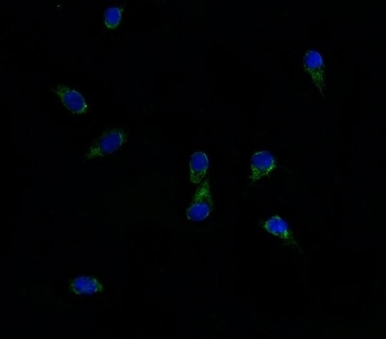 Immunofluorescent staining of FFPE human HepG2 cells with ABCG8 antibody (green) and DAPI nuclear stain (blue). HIER: steam section in pH6 citrate buffer for 20 min.~