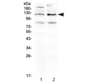 Western blot testing of 1) rat brain and 2) mouse brain lysate using GABA B Receptor 1 antibody at 0.5ug/ml. Predicted molecular weight: 108-130 kDa (multiple isoforms).