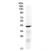 Western blot testing of human COLO320 cell lysate with NDRG3 antibody at 0.5ug/ml. Predicted molecular weight ~41 kDa.