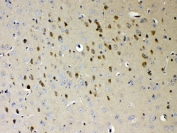 IHC testing of FFPE mouse brain tissue with NDRG3 antibody at 1ug/ml. Required HIER: steam section in pH6 citrate buffer for 20 min and allow to cool prior to testing.