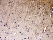 IHC testing of FFPE rat brain tissue with NDRG3 antibody at 1ug/ml. Required HIER: steam section in pH6 citrate buffer for 20 min and allow to cool prior to testing.