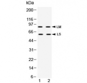 Western blot testing of human 1) HeLa and 2) K562 cell lysate with ADAM28 antibody at 0.5ug/ml. Predicted molecular weight: ~87 kDa (form LM) and ~61 kDa (form LS).