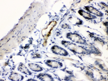 IHC testing of FFPE mouse intestine tissue with ANGPTL2 antibody at 1ug/ml. Required HIER: steam section in pH6 citrate buffer for 20 min and allow to cool prior to testing.