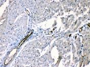 IHC testing of FFPE rat heart tissue with ANGPTL2 antibody at 1ug/ml. Required HIER: steam section in pH6 citrate buffer for 20 min and allow to cool prior to testing.