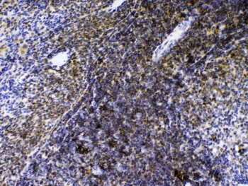 IHC testing of FFPE rat spleen tissue with AGO1 antibody at 1ug/ml. Required HIER: steam section in pH6 citrate buffer for 20 min and allow to cool prior to testing.
