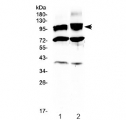 Western blot testing of 1) rat brain and 2) mouse brain lysate with HCN2 antibody at 0.5ug/ml. Predicted molecular weight: 97-105 kDa (unmodified), 115-130 kDa (glycosylated).